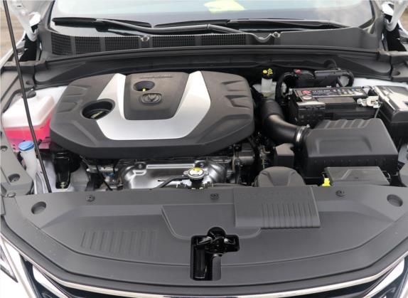 逸动XT 2018款 1.6L GDI 自动新潮型 国V 其他细节类   发动机舱