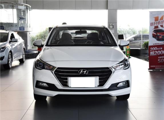 悦纳 2016款 1.6L 自动精英版TOP 外观   正前